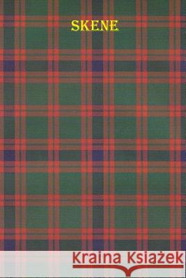 Skene I'm Reall 9781727064483 Createspace Independent Publishing Platform