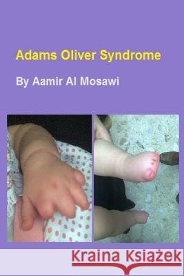 Adams Oliver syndrome: Clinical genetics Al Mosawi, Aamir Jalal 9781727678369