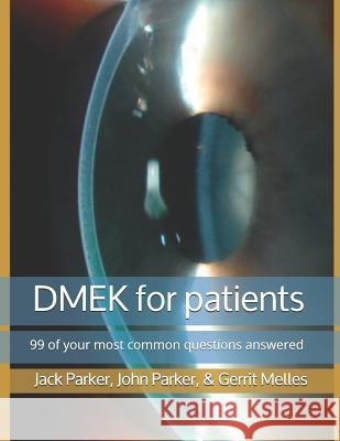 DMEK for patients: 99 of your most common questions answered Parker, John 9781728743004