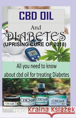 CBD Oil and Diabetes: All You Need to Know about CBD Oil for Treating Diabetes Ferdinand Quinone 9781728779287 Independently Published