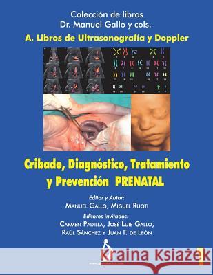 Cribado, Diagnóstico, Tratamiento Y Prevención Prenatal Ruoti, Miguel 9781730992544 Independently Published