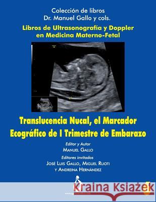 Translucencia Nucal, El Marcador Ecografico de I Trimestre de Embarazo Jose Padilla Manuel Gallo 9781731530967