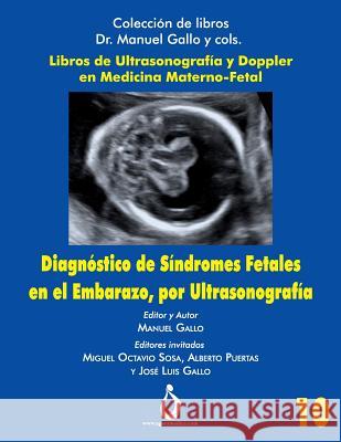 Diagnostico de Síndromes Fetales En El Embarazo, Por Ultrasonografia Padilla, Jose 9781731578969 Independently Published