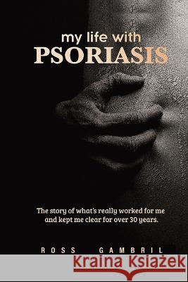 my life with PSORIASIS: The story of what finally worked for me and kept me clear for over 30 years! Ross Gambril 9781733802543 Gamco Publishing