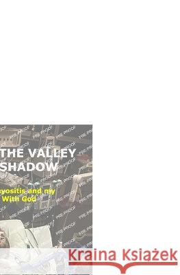 Through the Valley of the Shadow: Dermatomyositis and My Walk with God David Coleman 9781735601724 Rwb Publishing