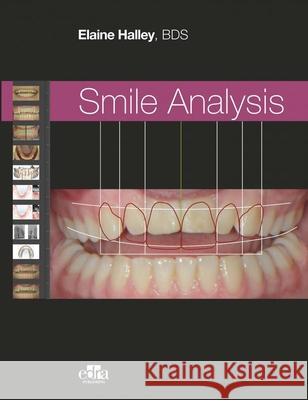 Smile Analysis Elaine Halley   9781737126119 Edra Publishing US LLC