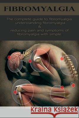 Fibromyalgia: The complete guide to fibromyalgia, understanding fibromyalgia, and reducing pain and symptoms of fibromyalgia with si David Anthony 9781761030314
