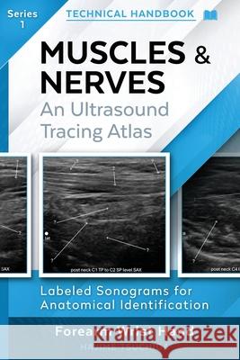 Technical Ultrasound Handbook - Muscles & Nerves: An Ultrasound Tracing Atlas (Series 1) Hajime Tsuchida 9781764437707 Hajime Tsuchida