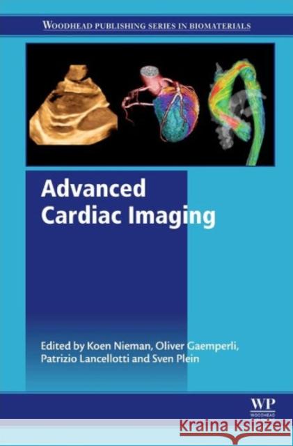 Advanced Cardiac Imaging Nieman, Koen Gaemperli, Oliver Plein, Sven 9781782422822