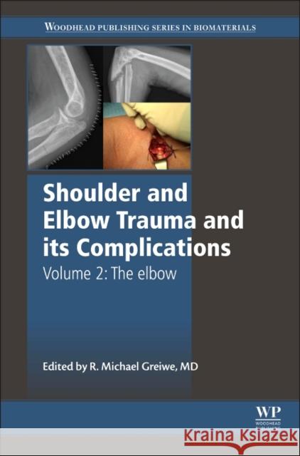 Shoulder and Elbow Trauma and Its Complications: Volume 2: The Elbow Greiwe, Michael   9781782424505 Elsevier Science