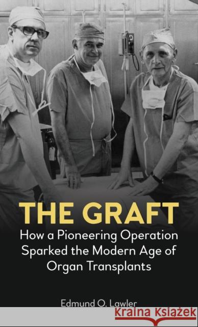 The Graft: How a Pioneering Operation Sparked the Modern Age of Organ Transplants Edmund O 9781785278341 Anthem Press