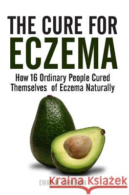 The Cure for Eczema Ewan M Cameron 9781785550393 Inspired Publications