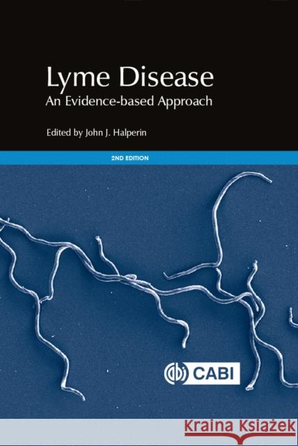 Lyme Disease: An Evidence-Based Approach John Jay Halperin 9781786392077