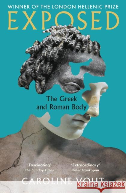 Exposed: The Greek and Roman Body - Shortlisted for the Anglo-Hellenic Runciman Award  9781788162913 PROFILE BOOKS
