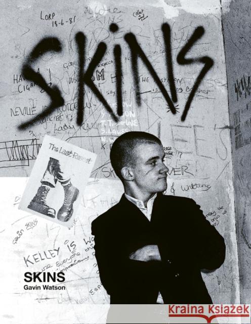 Skins: Gavin Watson Gavin Watson 9781788842150 Acc Art Books