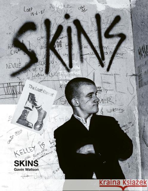 Skins: Gavin Watson Watson, Gavin 9781788842167 ACC Art Books