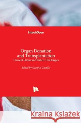 Organ Donation and Transplantation: Current Status and Future Challenges Georgios Tsoulfas 9781789233407