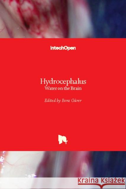 Hydrocephalus: Water on the Brain G 9781789234862 Intechopen