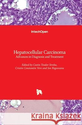 Hepatocellular Carcinoma: Advances in Diagnosis and Treatment Costin Teodor Streba Cristin Constantin Vere Ion Rogoveanu 9781789842739 Intechopen