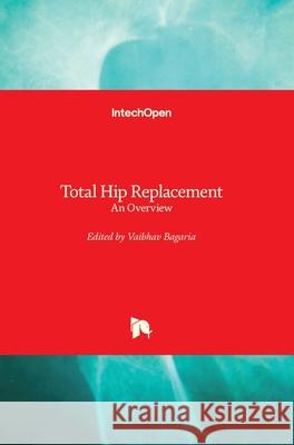 Total Hip Replacement: An Overview Vaibhav Bagaria 9781789843811 Intechopen