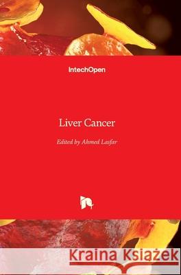 Liver Cancer Ahmed Lasfar 9781789844481 Intechopen