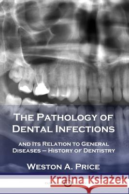 The Pathology of Dental Infections: and Its Relation to General Diseases - History of Dentistry Weston a. Price 9781789872279 Pantianos Classics