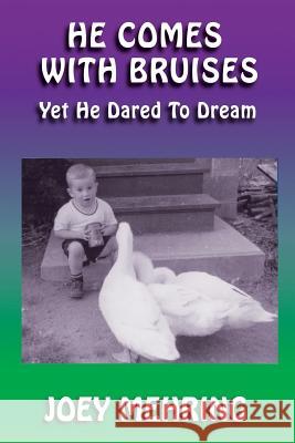 He Comes with Bruises: Yet He Dared To Dream Joey Mehring 9781790129003