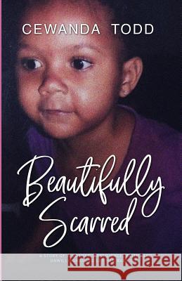 Beautifully Scarred: A Story of a Mother's Resilience, Faith, and Unwillingness to Let Her Baby Die. Cewanda Todd 9781790210992