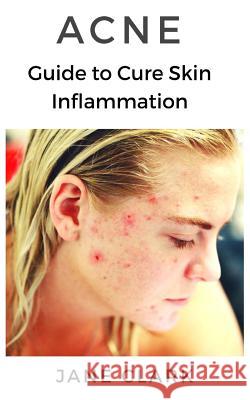 Acne: Guide to Cure Skin Inflammation Jane Clark 9781795744393