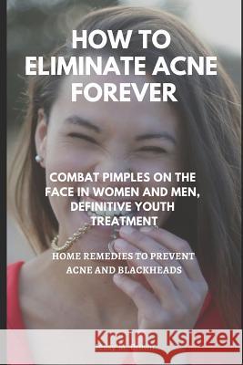 How to Eliminate Acne Forever: Combat Pimples on the Face in Women and Men, Definitive Juvenile Treatment, Home Remedies to Prevent Acne and Blackhea Jessy M. Brown 9781796544435 Independently Published
