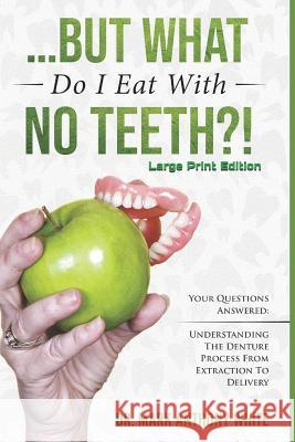 ... But What Do I Eat with No Teeth?! Your Questions Answered: Understanding the Denture Process from Extraction to Delivery: Large Print Mark Anthony White 9781797597690 Independently Published