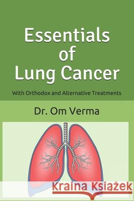 Essentials of Lung Cancer: With Orthodox and Alternative Treatments Aishvarya Sharma Om Verma 9781798840474