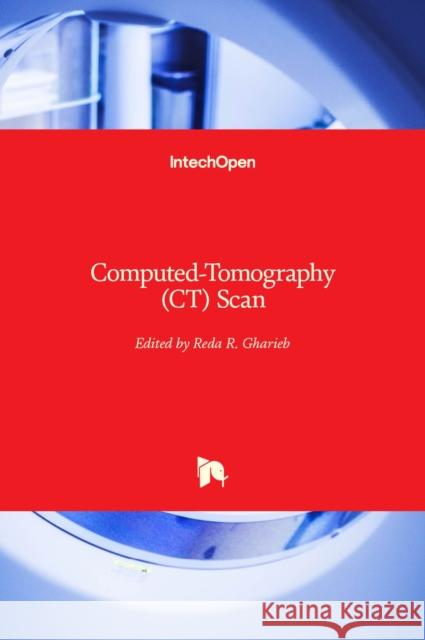 Computed-Tomography (CT) Scan Reda R. Gharieb 9781803551173