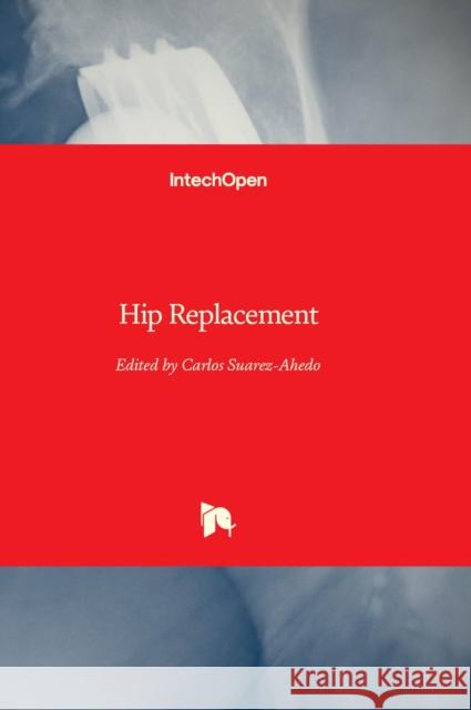 Hip Replacement Carlos Suarez-Ahedo 9781803557595