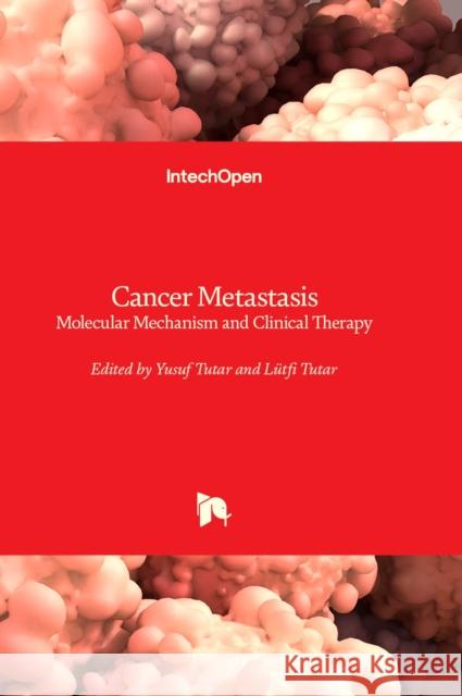 Cancer Metastasis: Molecular Mechanism and Clinical Therapy Yusuf Tutar, Lütfi Tutar 9781803561615