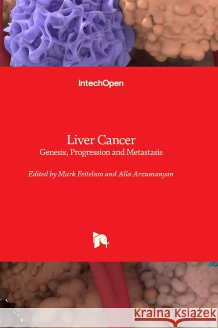 Liver Cancer: Genesis, Progression and Metastasis Mark Feitelson, Alla Arzumanyan 9781803564135