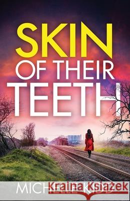 Skin of Their Teeth Michelle Kidd 9781805733096 Joffe Books