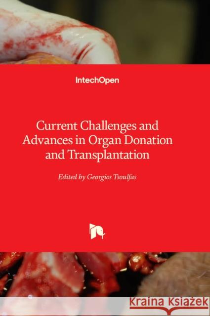 Current Challenges and Advances in Organ Donation and Transplantation Georgios Tsoulfas 9781837680054