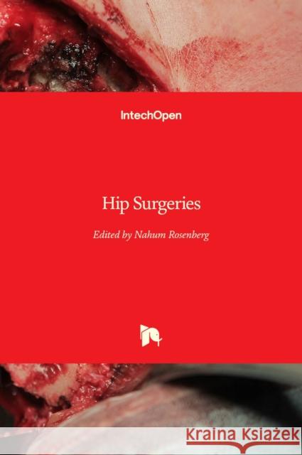 Hip Surgeries Nahum Rosenberg 9781838802356 Intechopen