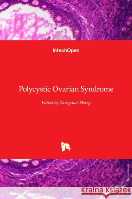 Polycystic Ovarian Syndrome Zhengchao Wang 9781838802899 Intechopen