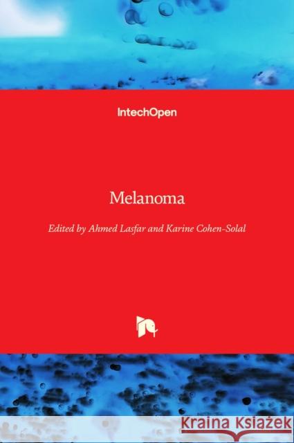 Melanoma Ahmed Lasfar Karine Cohen-Solal 9781838808785 Intechopen