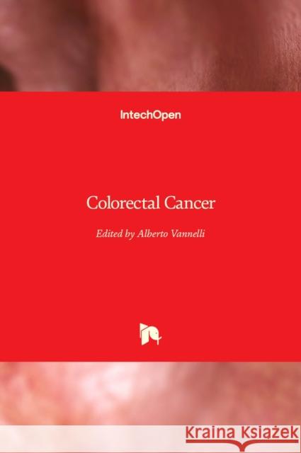 Colorectal Cancer Alberto Vannelli 9781838811020 Intechopen