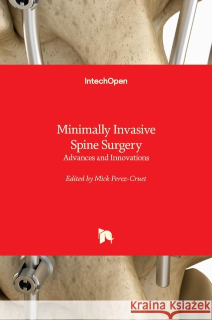 Minimally Invasive Spine Surgery: Advances and Innovations Mick Perez-Cruet 9781839623011 Intechopen