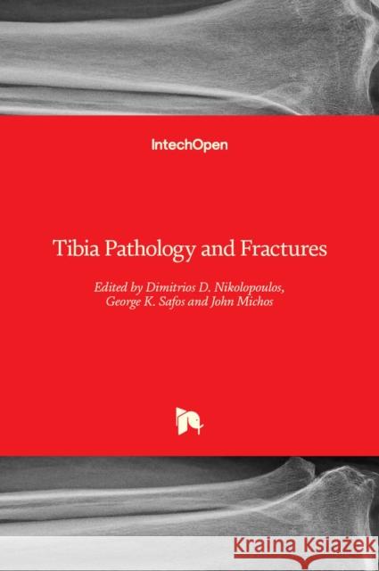 Tibia Pathology and Fractures Dimitrios D. Nikolopoulos George K. Safos John Michos 9781839624063