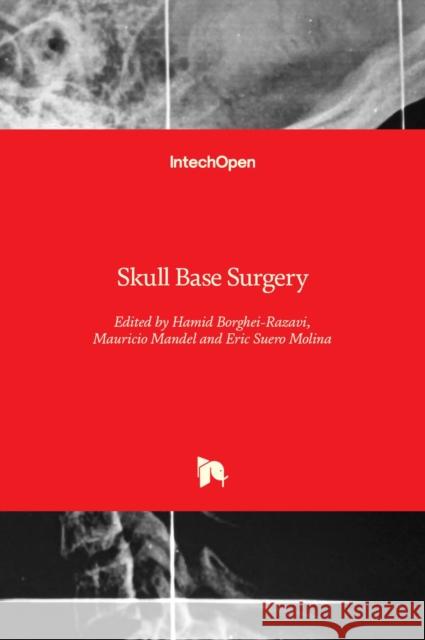 Skull Base Surgery Hamid Borghei-Razavi, Mauricio Mandel, Eric Suero Molina 9781839626326 IntechOpen