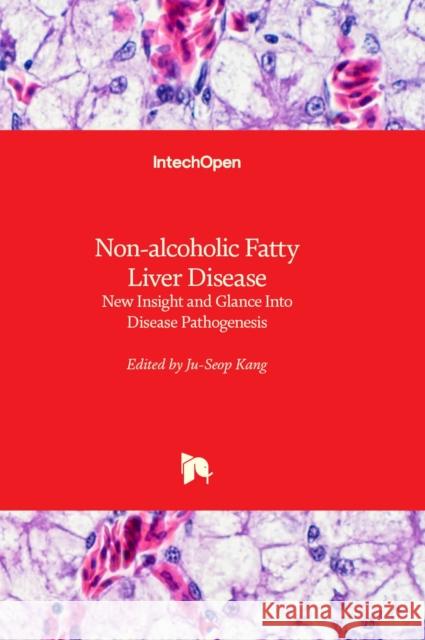 Non-alcoholic Fatty Liver Disease: New Insight and Glance Into Disease Pathogenesis Ju-Seop Kang 9781839680908 IntechOpen