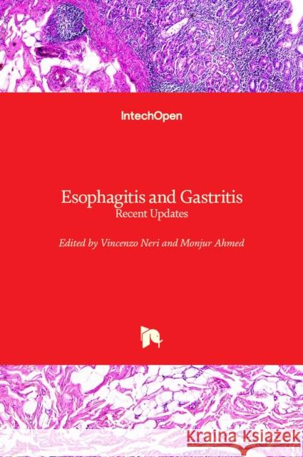 Esophagitis and Gastritis: Recent Updates Vincenzo Neri Monjur Ahmed 9781839690594