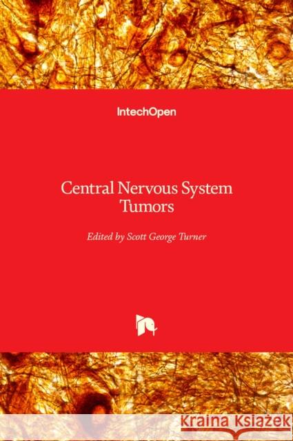 Central Nervous System Tumors Scott Turner 9781839693069