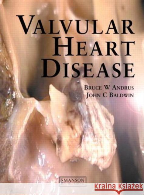Valvular Heart Disease Bruce Andrus John Baldwin 9781840760583 MANSON PUBLISHING LTD