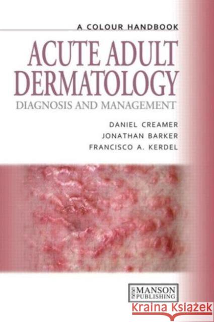 Acute Adult Dermatology : Diagnosis and Management: A Colour Handbook  Creamer 9781840761023